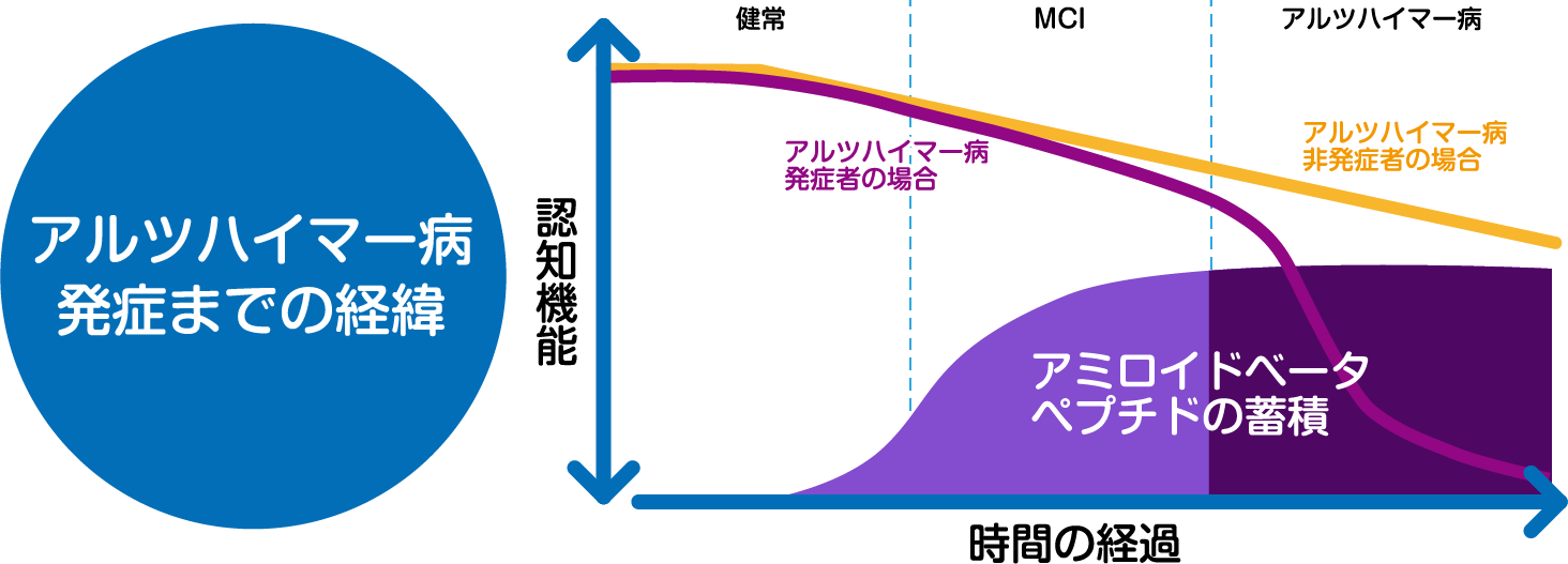 軽度認知障害(MCI)とは