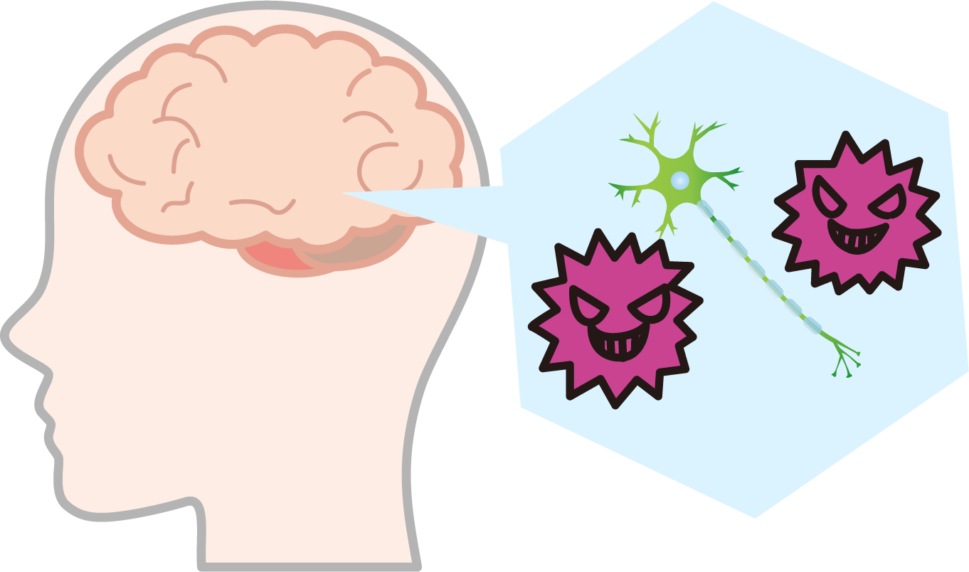 MCIスクリーニング検査